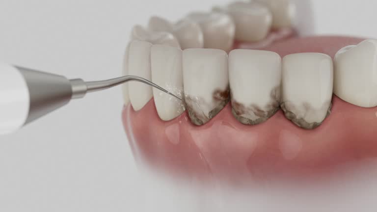 Trusted Invisalign Clear Aligners service in Clinton, MS - Dentist Open Now